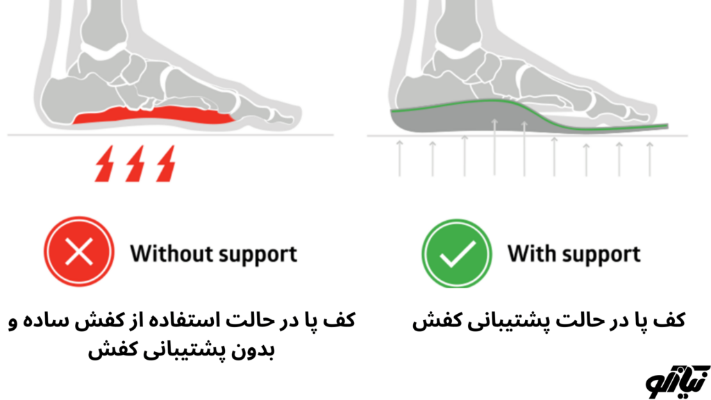 کفش طبی ارتوپدی زنانه